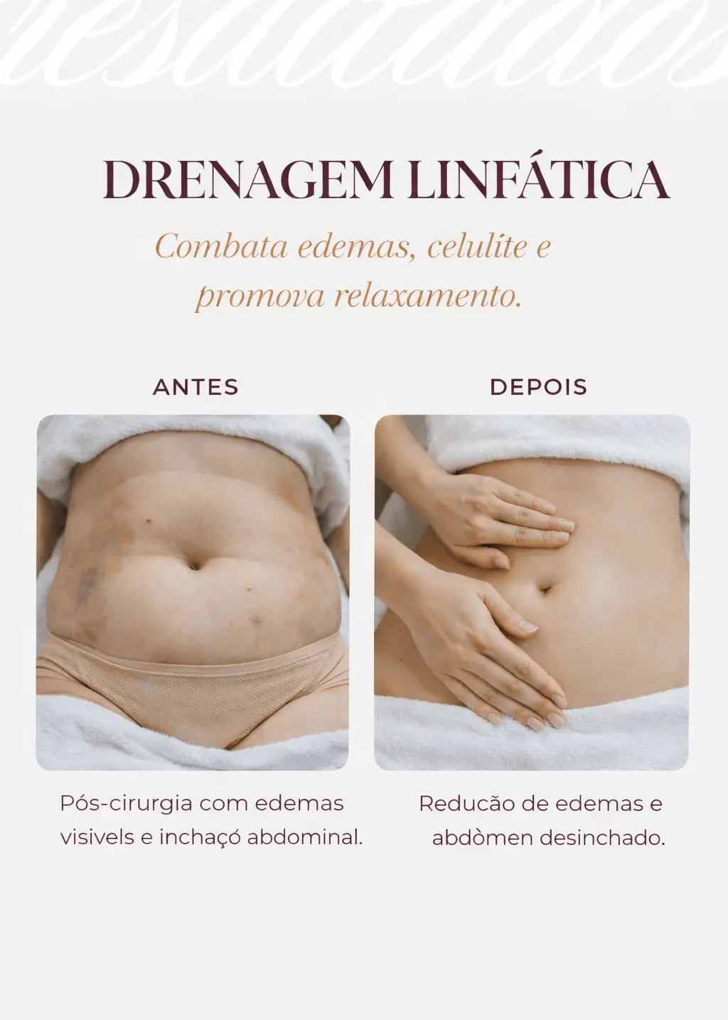 Comparativo antes e depois de Drenagem Linfática