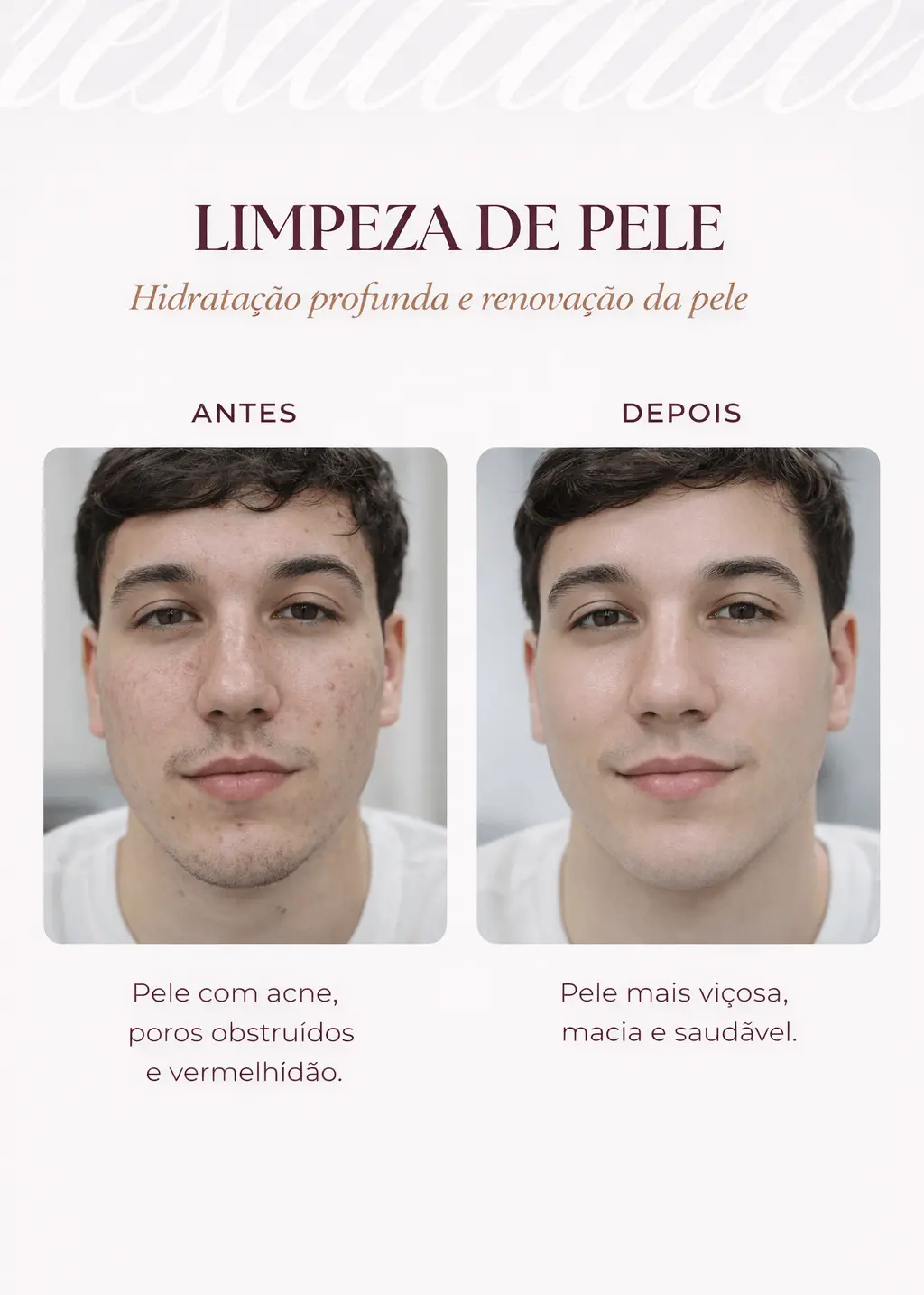 Comparativo antes e depois de Limpeza de Pele