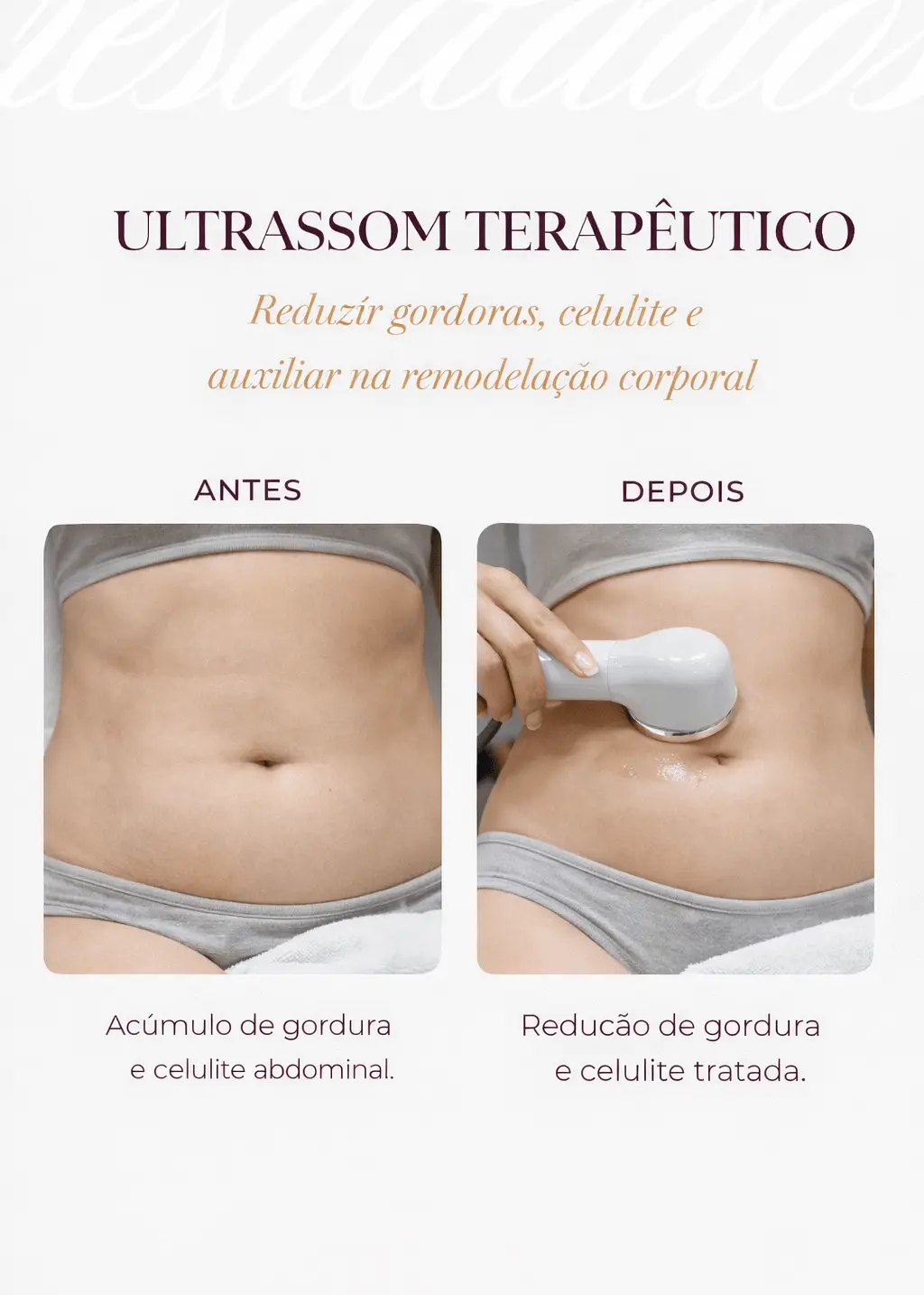 Comparativo antes e depois de Ultrassom Terapêutico