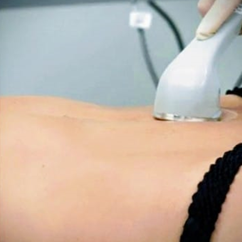 Ultrassom Terapêutico